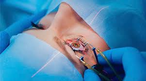 Especialista explica como cirurgia de catarata pode mudar a qualidade de vida dos pacientes